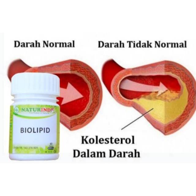 BIOLIPID NATURINDO HERBAL OBAT KOLESTEROL KOLESTROL