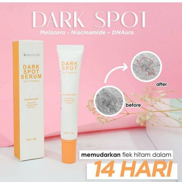 

Dark spot