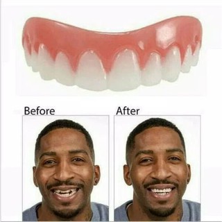 Gigi Palsu Veneer Gigi Ompong Tambal Teeth Estetika