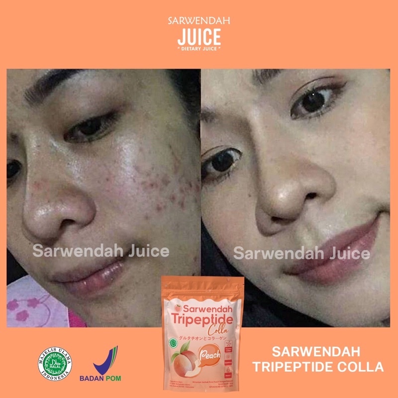 TRIPEPTIDE COLLA PEACH POUCH / COLLAGEN PEACH MENCERAHKAN BADAN WAJAH / MEMUDARKAN BEKAS LUKA SECARA ALAMI / ANTI AGING / WHITENING BOOSTER COLLAGEN