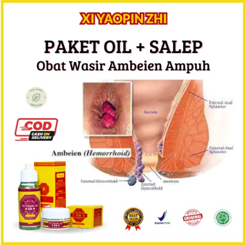 Xi Yaopin Zhi Paket OIL + SALEP Obat Wasir Ambeien Atasi Benjolan Ambeyen Berdarah Bernanah BPOM (COD)