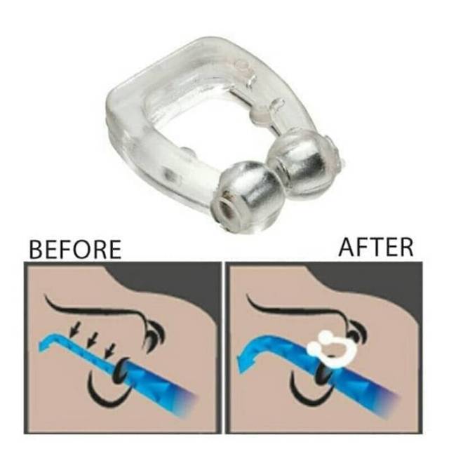 Alat Anti Dengkur Penghilang Ngorok Snore Free Magnetic Noseclip