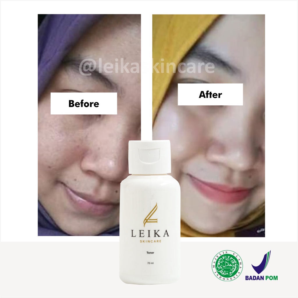 Bikin Glowing! Toner Pelembab Wajah Cepat Pelembab Wajah Kering Berminyak Bikin Putih dan Glowing Ampuh Toner Leika Skincare Halal MUI Resmi BPOM