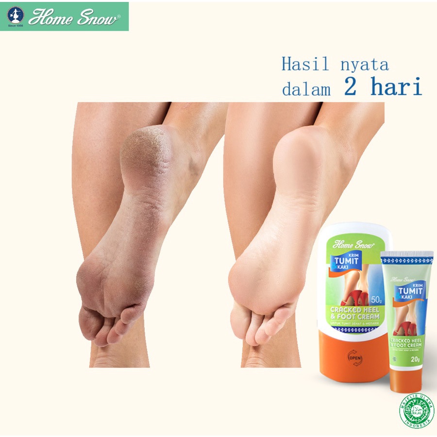 Home Snow Cracked Heel &amp; Foot Cream 20 &amp; 50 gr Krim Perawatan Kaki dan Tumit WHS