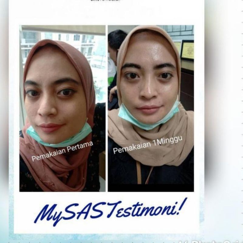 Cream MySas Skincare Paket oily / paket lengkap MySas Skincare/ paket acne/ cream jerawat