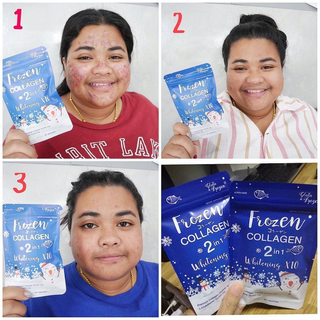 Niazaraa Store 60 100 Original Whitening Glowing Frozen Collagen Frozen Asli Thailand Untuk Shopee Indonesia