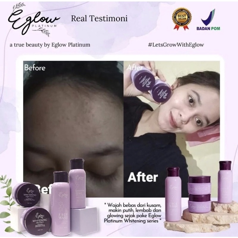 E GLOW PLATINUM SKINCARE | PAKET WAJAH WHITENING ACNE ULTIMATE | PENCERAH PEMUTIH PENGHILANG FLEK NODA HITAM JERAWAT BEKAS JERAWAT PADA WAJAH VIRAL AMAN BPOM