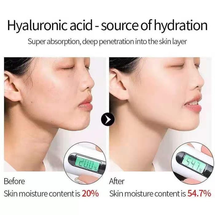 LAIKOU Serum Hyaluronic Acid untuk Melembabkan / Menghilangkan Jerawat