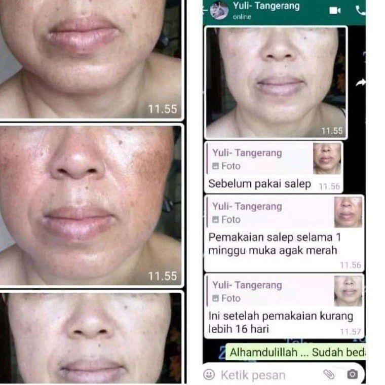 [KODE PDQRJ] Salep Flek dr Liz / Lis night Cream / Liz night whitening / saleb flek Lis skincare