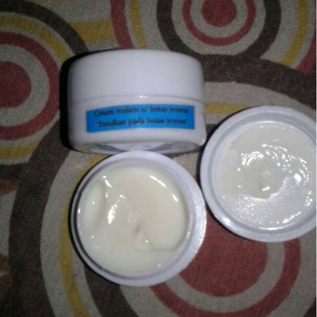 DJ GLOW SKIN PENGHILANG BEKAS JERAWAT