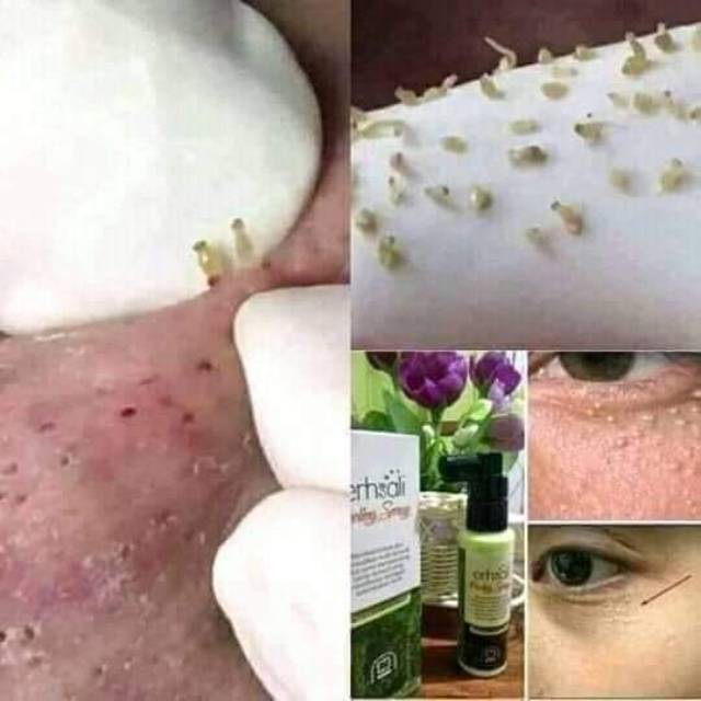 Peling Sepray Pembersih Daki Shopee Indonesia