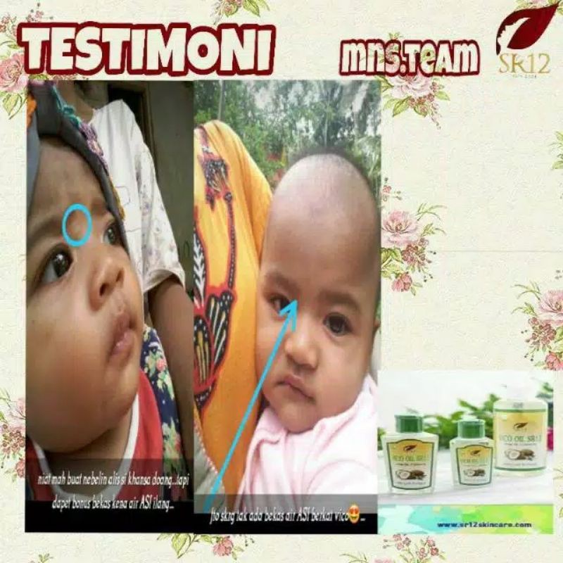 

VCO OIL SEJUTA MANFAAT