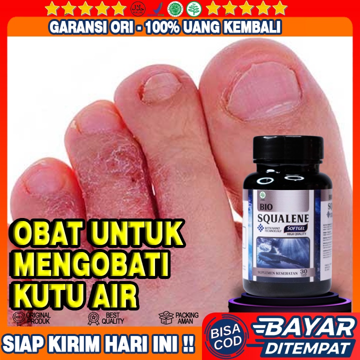 Obat Kutu Air - Obat Kutu Air Pada Kaki  - Obat Penghilang Kutu Air Di Kaki Dan Tangan - Obat Gatal 