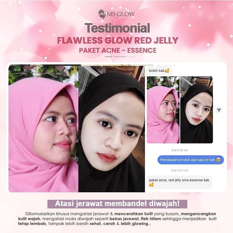 Ms Glow Red Jelly Extra Glowing Original 100% Cream Sejuta Manfaat , Lactobacillus 2% Ms Glow