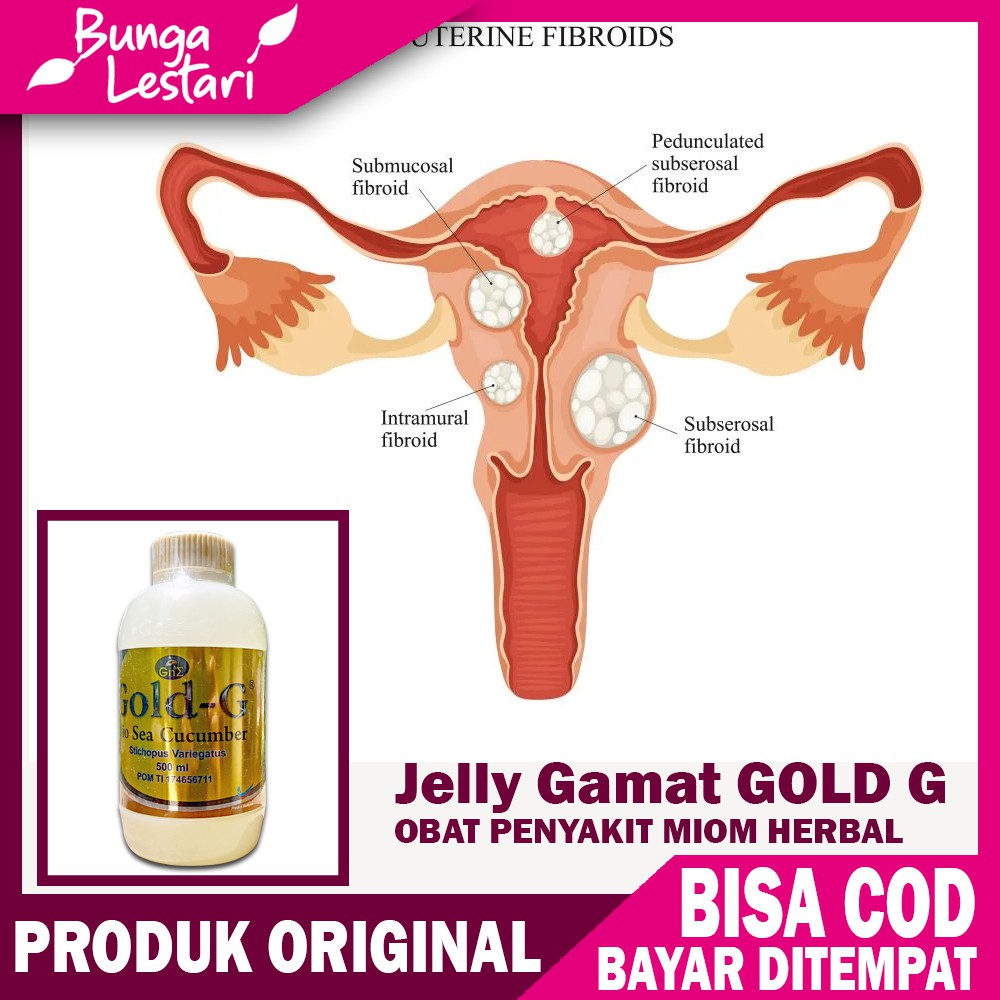 

OBAT MIOM TANPA OPERASI HERBAL DI APOTIK