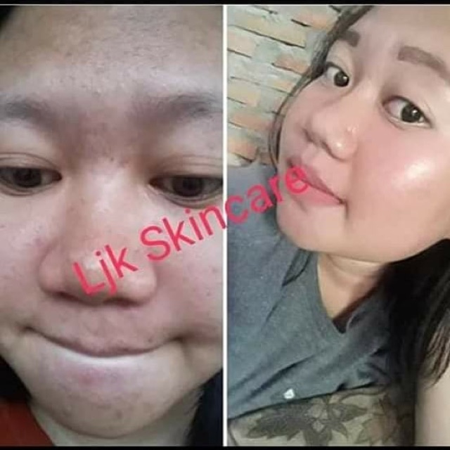 Skincare Ljk BPOM