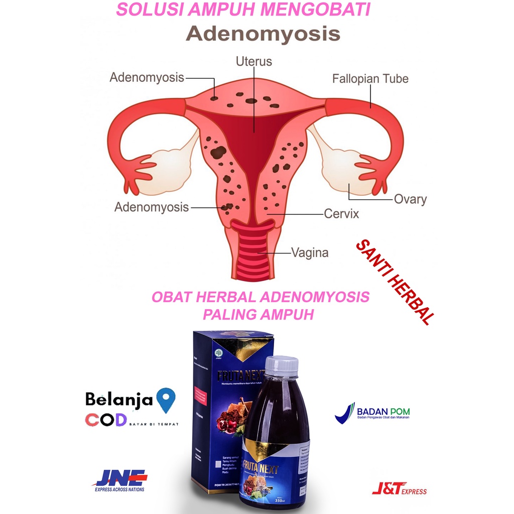 FRUTANEXT Obat Adenomiosis Pelancar Menstruasi Berkepanjangan Obat Mengatasi Pendarahan Deras