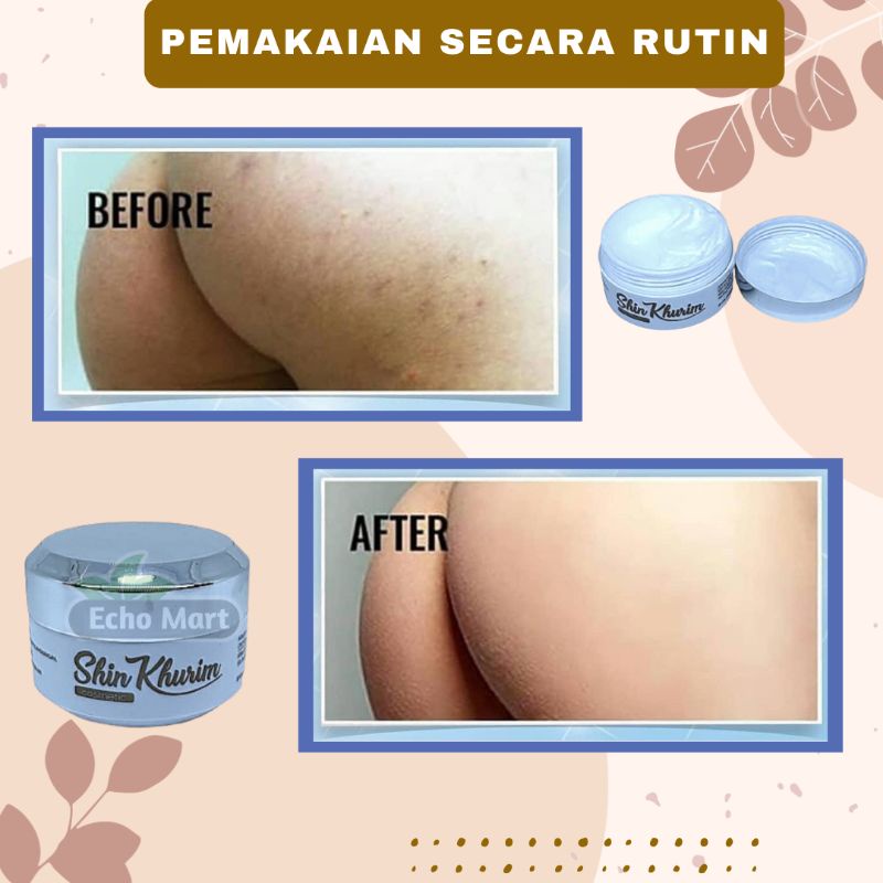 Cream Pemutih Pencerah Ketiak Selangkangan Ampuh BPOM Shin Kurim Shin Khurim Original Krim Pemutih Bokong Leher Sikut Lutut Leher Pantat Ketek Dengkul Siku Obat Lotion Memutihkan Lipatan Selangkangan Ketiak Hitam Membandel Permanen Underarm Ori