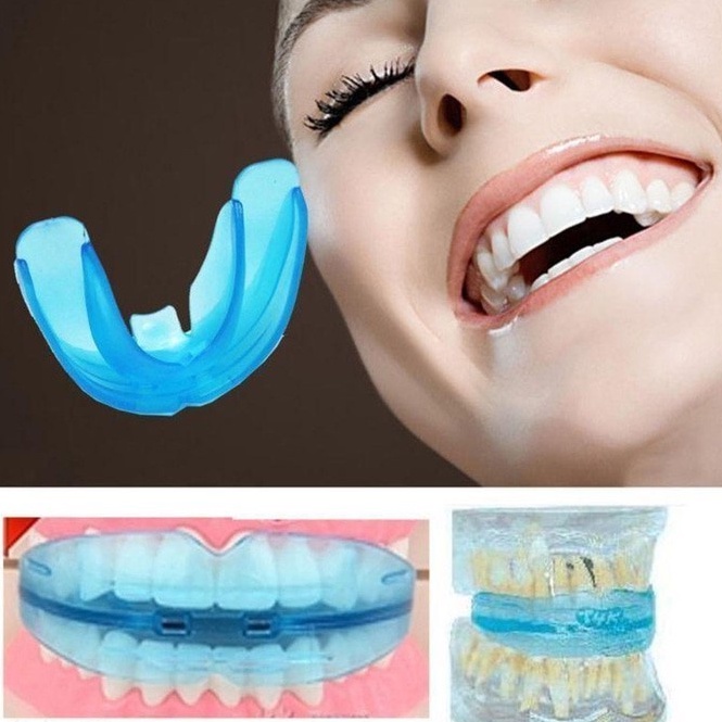 BEHEL TOOTH ORTHODONTIC / BEHEL GIGI