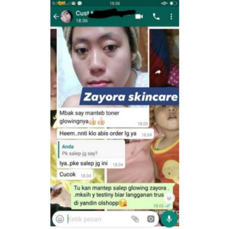 Toner Glowing Zayora 20 ml Ampuh menglowingkan Wajah