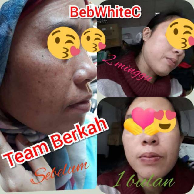 

BBC skincare BPOM