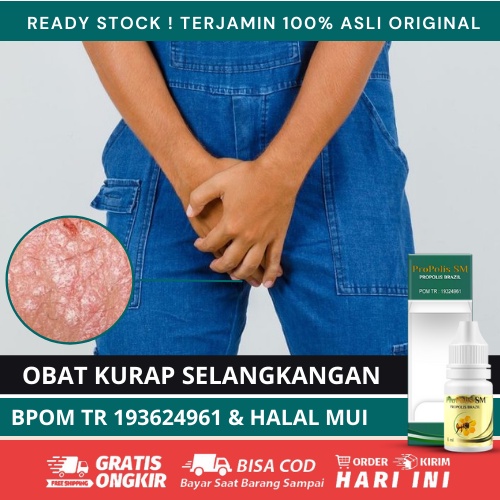 Jual Obat Gatal Atlet Kurap Selangkangan, Penghilang Kurap, Jamur
