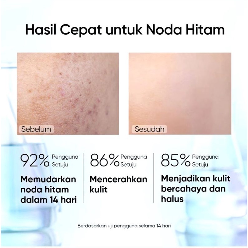 SKINTIFIC SymWhite 377 Dark Eraser Spot Serum Mencerahkan Kulit Brightening Serum Penghilang Flek Hitam Pencerah 20ML