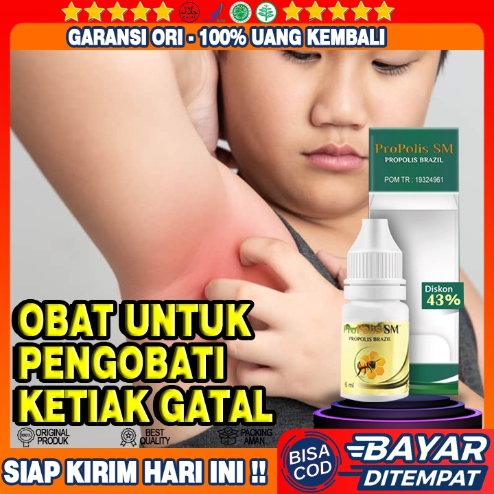 Obat Ketiak Gatal, Obat Penghilang Jamur Gatal Ketiak, Obat Infeksi Ketiak Gatal, Propolis SM ASLI