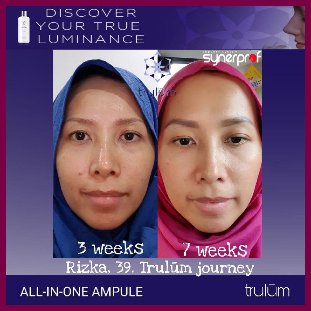 Cream Krim Penghilang Kerutan Wajah | Trulum Mengencangkan Wajah Anda