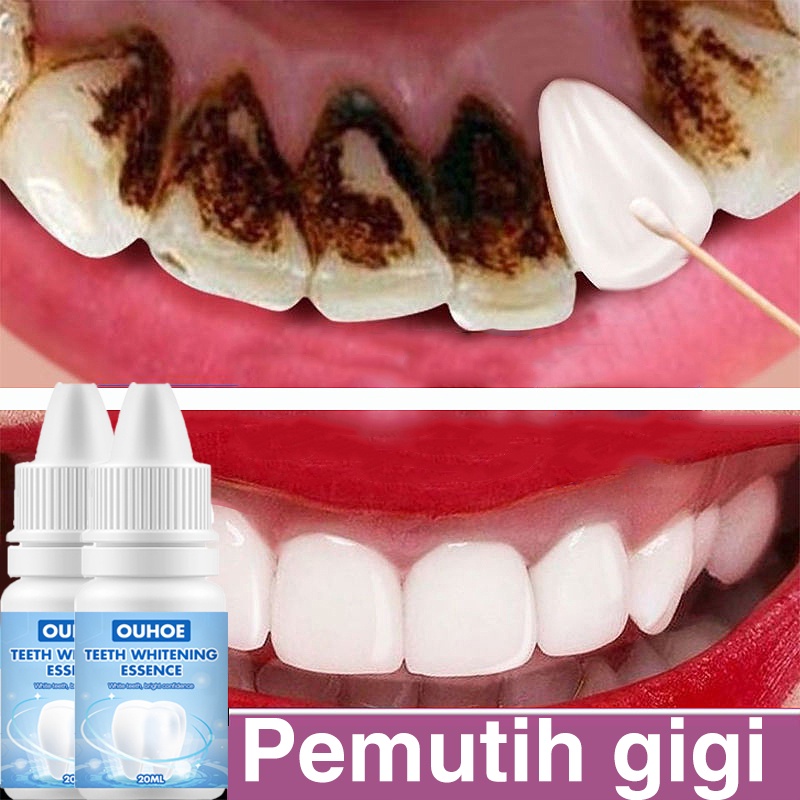 [COD]Pemutih Gigi Kuning Kerak Penghilang Karang Permanen Original Ampuh Teeth Whitening Menghapuskan plak gigi dan noda asap menghapuskan bau mulut