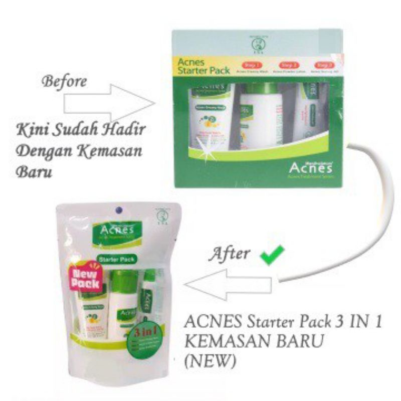 `ღ´ PHINKL `ღ´ a̳c̳n̳e̳s̳ Acnes Starter 3 In 1 Pack trial kit untuk jerawat totol flek berjerawat gradakan memperbaiki skin barrier