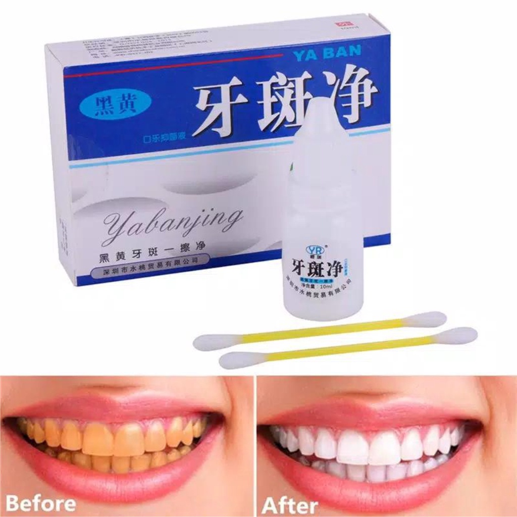 ORIGINAL 100% YABANJING PEMUTIH PEMBERSIH GIGI KUNING PENGHILANG PERONTOK KARANG GIGI 100% AMAN MANJUR TERBUKTI WHITENING TEETH ODOL CAIRAN CREAM