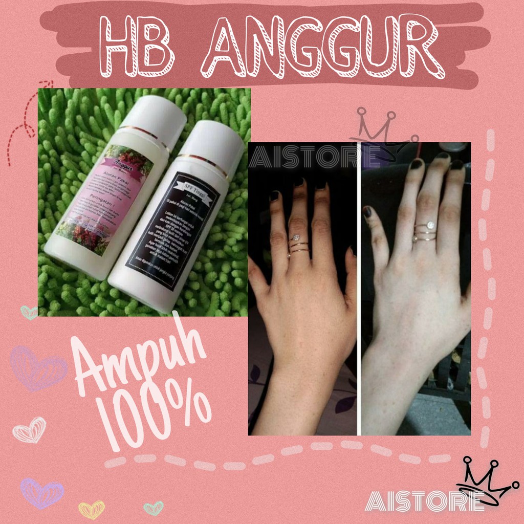 HAND BODY LOTION PEMUTIH TANGAN KAKI BADAN PERMANEN AMPUH AMAN HB ANGGUR ORIGINAL