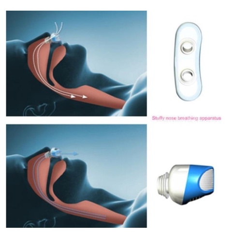 Anti Dengkur Alat Pernafasan Hidung Stop Snoring Solution Anti Ngorok