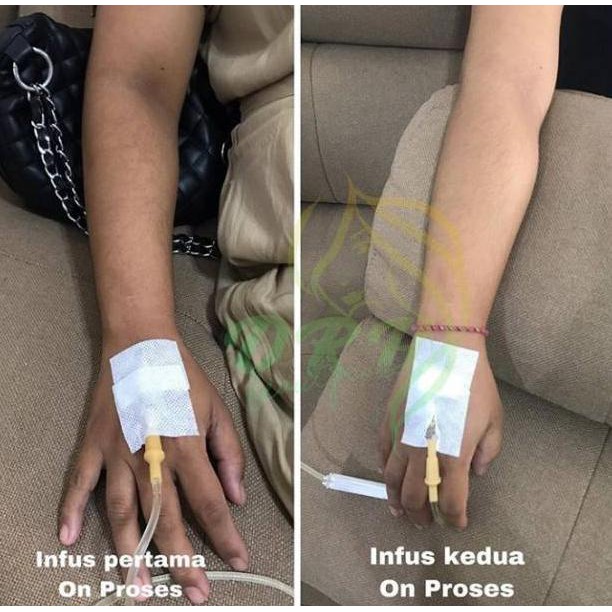 Terbaru Hari Ini> Infus whitening japan versi chromosome /pemutih badan/Kualitas terbaik/Original 