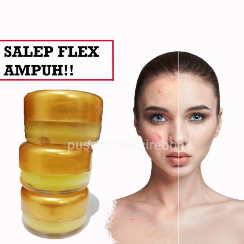 Salep Flek Hitam Melasma Ampuh | Salep Wajah Menghilangkan Flex Hitam Dan Jerawat