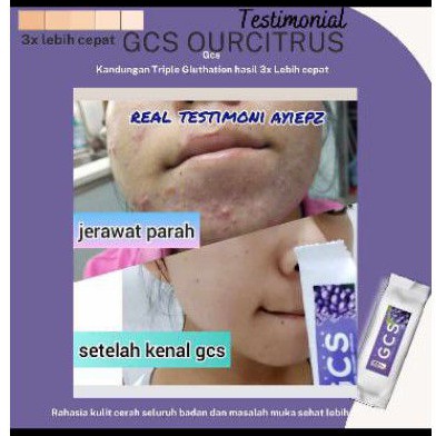 [5 sachet ] MINUMAN GLUTATHIONE COLLAGEN - GCS REVIVAR -  ampuh atasi jerawat