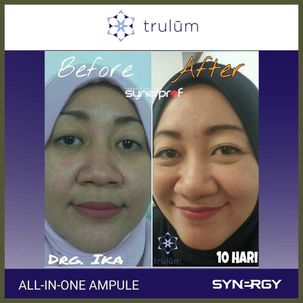 Trulum krim Cream Pemutih Wajah Cepat Aman Permanen untuk Pria Wanita