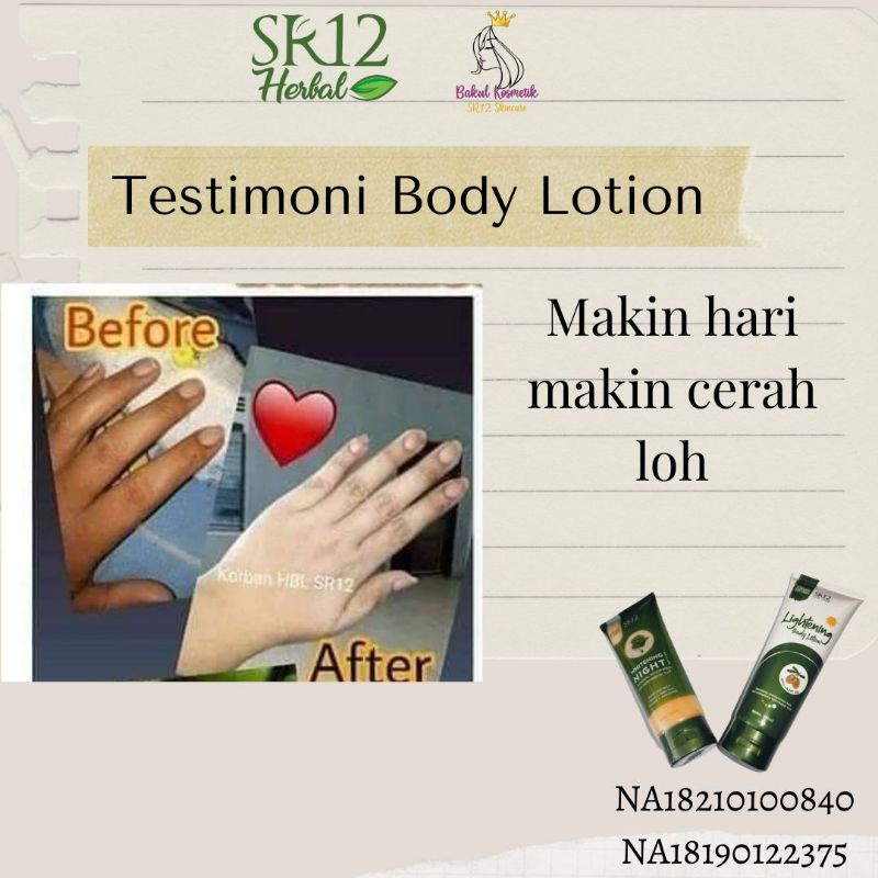 Body Lotion SR12 Pemutih Pencerah Kulit Kaki Tangan Belang Seluruh Badan Penghilang Bekas Luka Perma