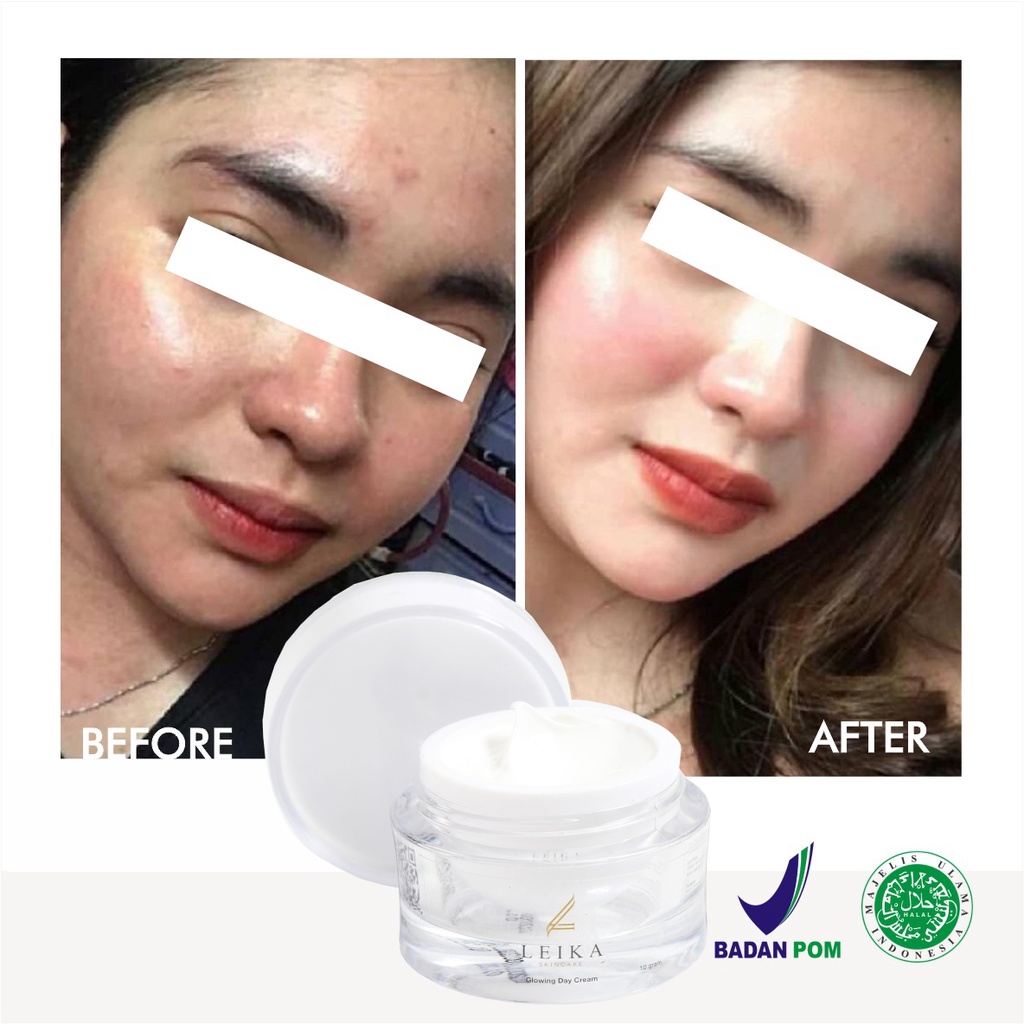 Glowing Putih Cepat! Krim untuk Kulit Wajah Glowing Putih Cepat Original BPOM Halal Murah Ampuh Cream Wajah Glowing Korea Asli Permanen Glowing Day Cream Leika Skincare 10gr Resmi BPOM