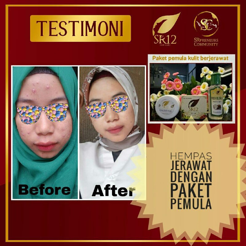 PAKET PEMULA SR12 KOMPLIT / PERAWATAN SKINCARE AMAN &amp; ALAMI / PENETRAL KULIT / PAKET PERAWATAN WAJAH