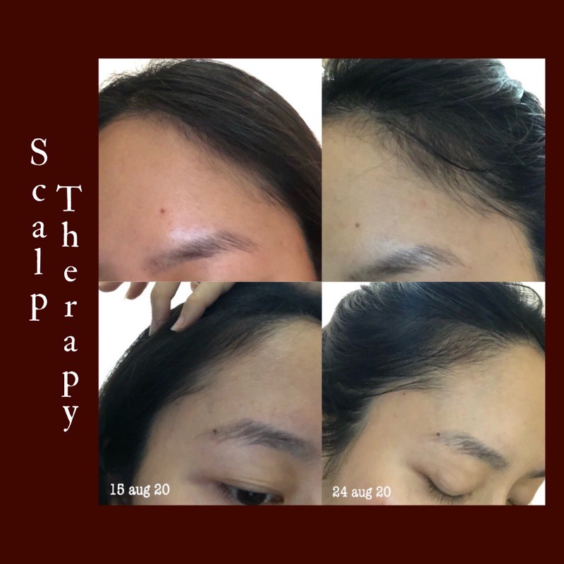 Scalp Therapy Natural Vegan Water-Based Hair Tonic - Everlaskin-2