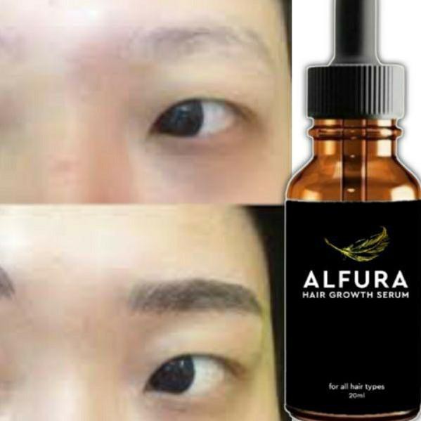 ➽ ALFURA SERUM PENUMBUH RAMBUT ALIS BREWOK AMPUH ✸