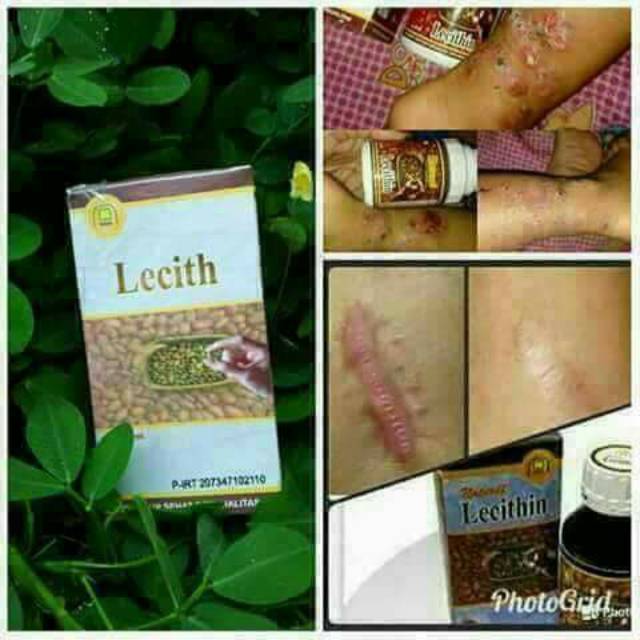 

lecithin