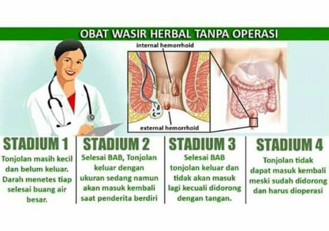 Ambejos Salwa De Nature Obat Wasir Ambeien Stadium 2 3 4 Paling Ampuh Shopee Indonesia