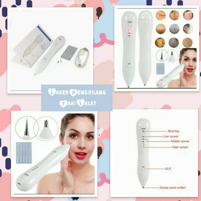 Laser Penghilang Tahi Lalat