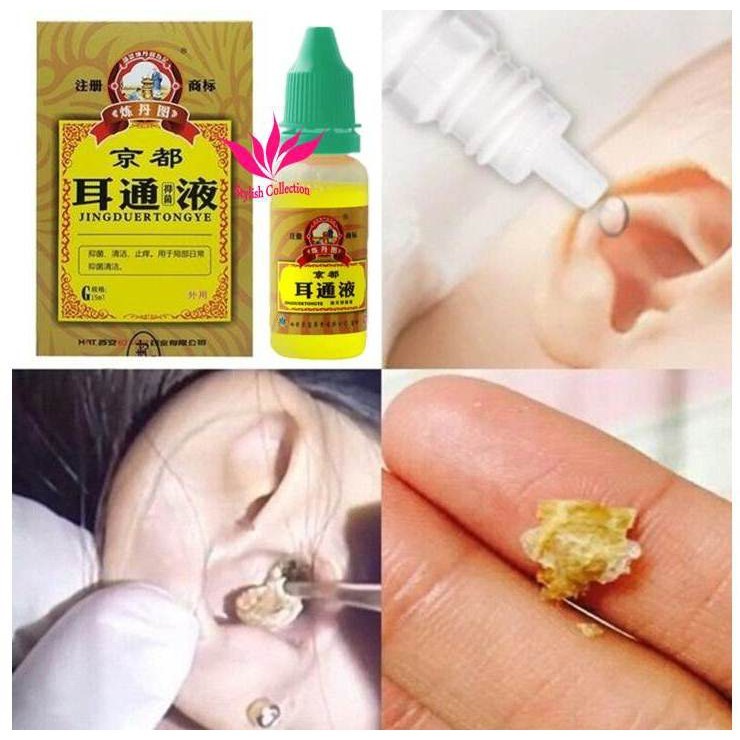 (Original) Obat Tetes Telinga / Cairan Tetes Telinga Herbal / JINGDUERTONGYE Pembersih Kotoran