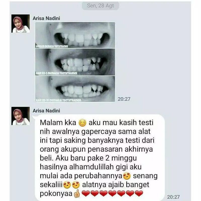 ALAT PERAPI GIGI PENGGANTI BEHEL ORIGINAL TEETH MERAPIKAN MENATA GIGI PERATA