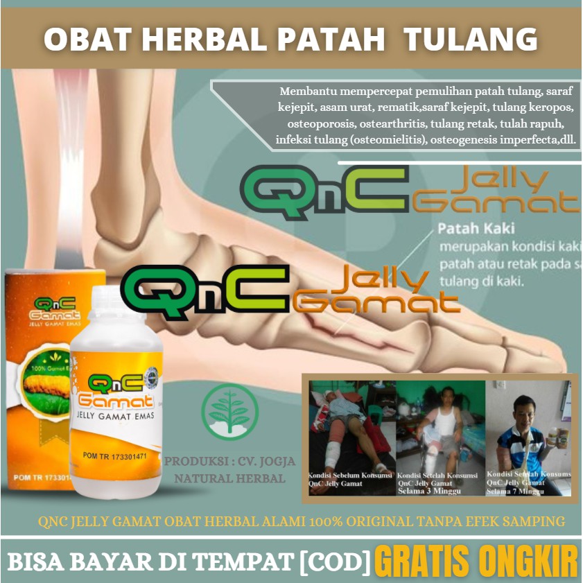 Obat Patah Tulang, Obat Tulang Keropos, Obat Tulang Rawan, Tulang Paget, Obat Untuk Anak & Dewasa