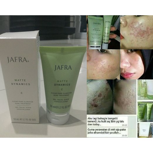 Terbaru Cream Jerawat Acne Lotion Ampuh Menghilangkan Jerawat Solusi Efektif Sebagai Obat Shopee Indonesia